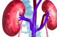 बदलती जीवनशैली और अनियमित खान-पान से बढ़ रहा किडनी रोग का खतरा, डॉक्टरों ने दी चेतावनी